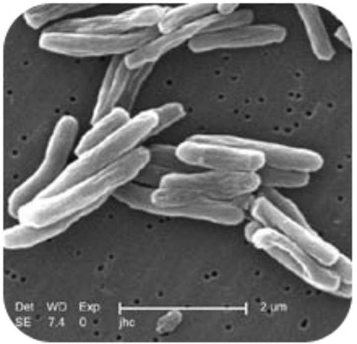 Bacteria dañina