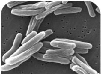 Bacteria dañina