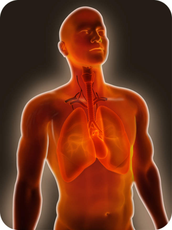 Enfermedades y trastornos del sistema respiratorio - Avanzado Enfermedades y trastornos del sistema respiratorio - Avanzado